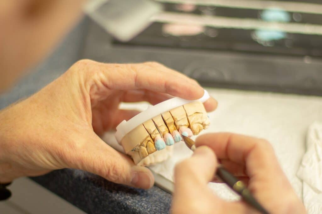 Why Tooth Replacement is Essential for Your Oral Health