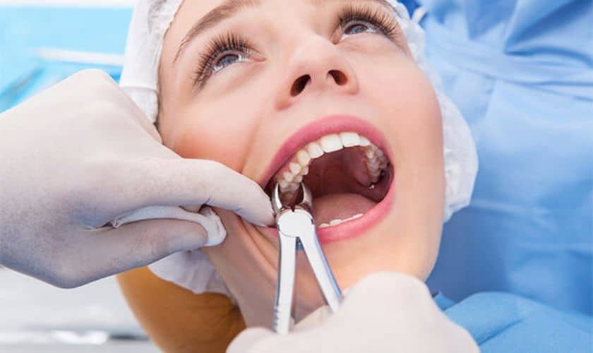 Tooth Extractions Midwest City OK