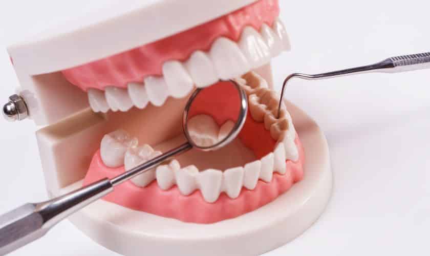 Rediscover Confidence with Custom Dentures