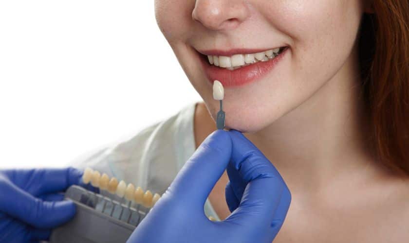 Porcelain Veneers Midwest City Ok